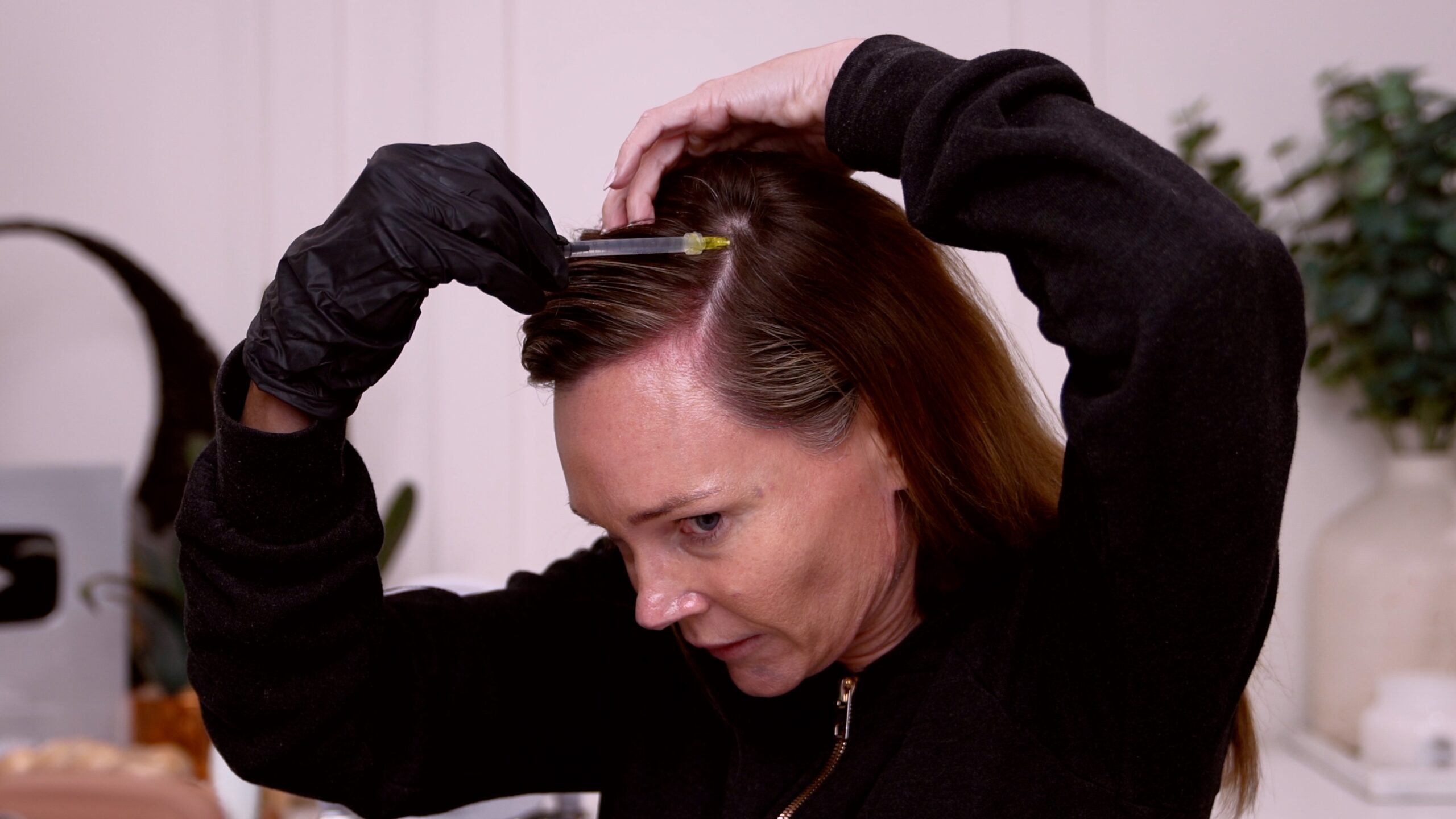 Kim holding a syringe near a parted section of her scalp during the App-only HairLuma portion
