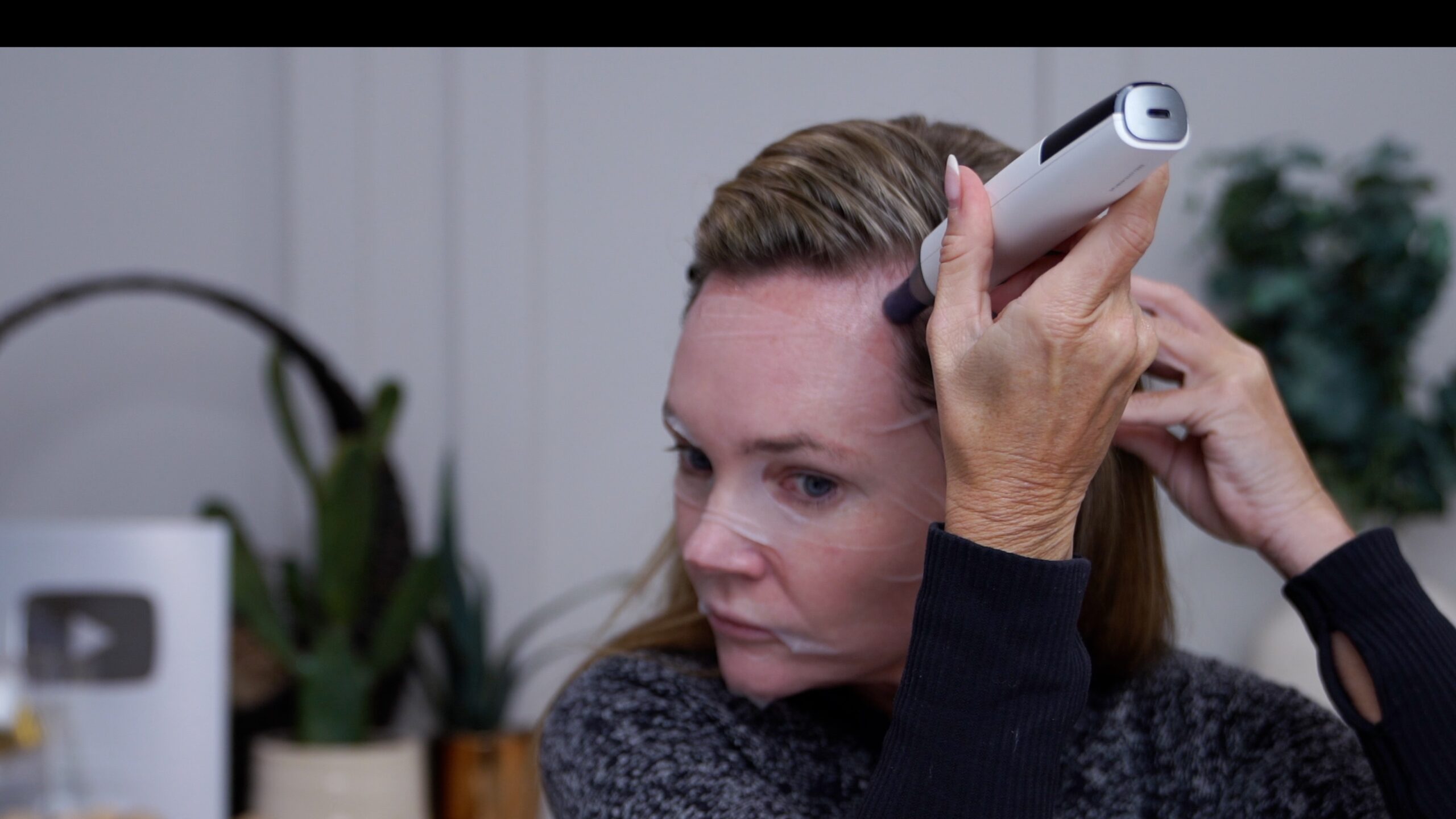 Kim using a microneedling device along the front hairline