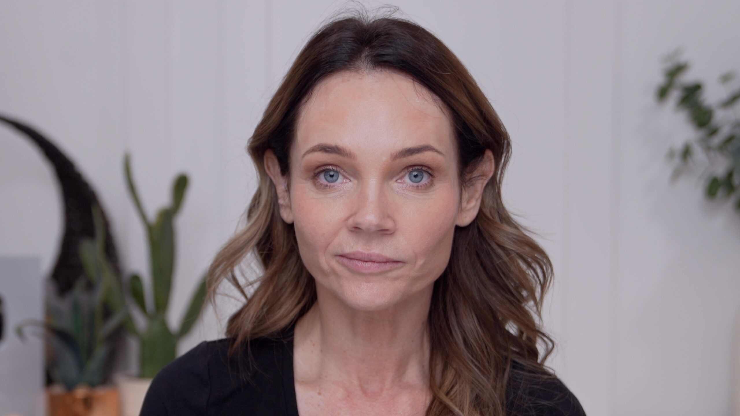 Kimberly before her first cheek filler treatment in December 2025