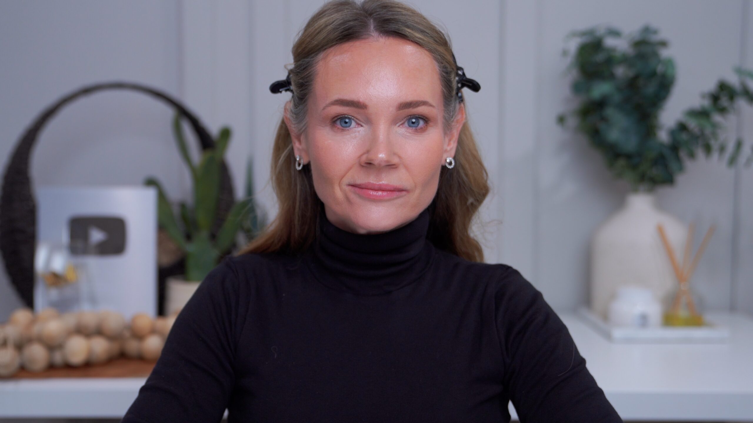 Kimberly in her nine-month cheek filler update after additional aesthetic treatments