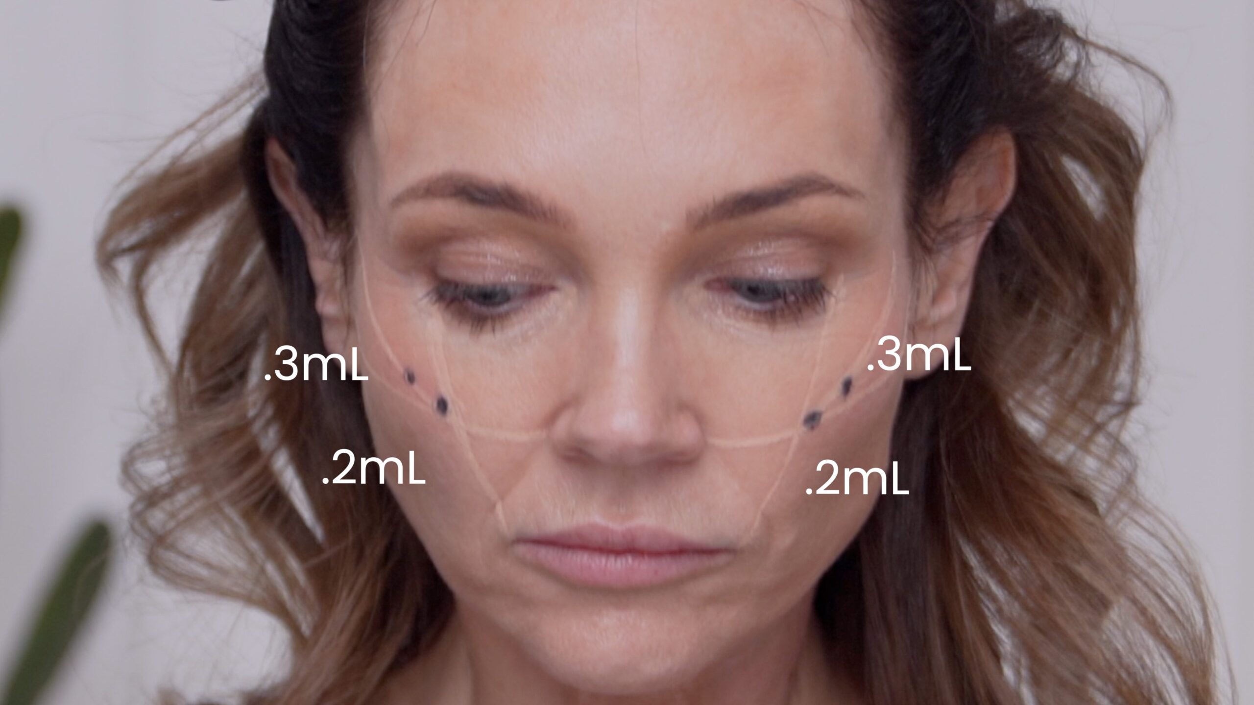 Front view of Kimberly’s original cheek markings and labeled product distribution on both sides