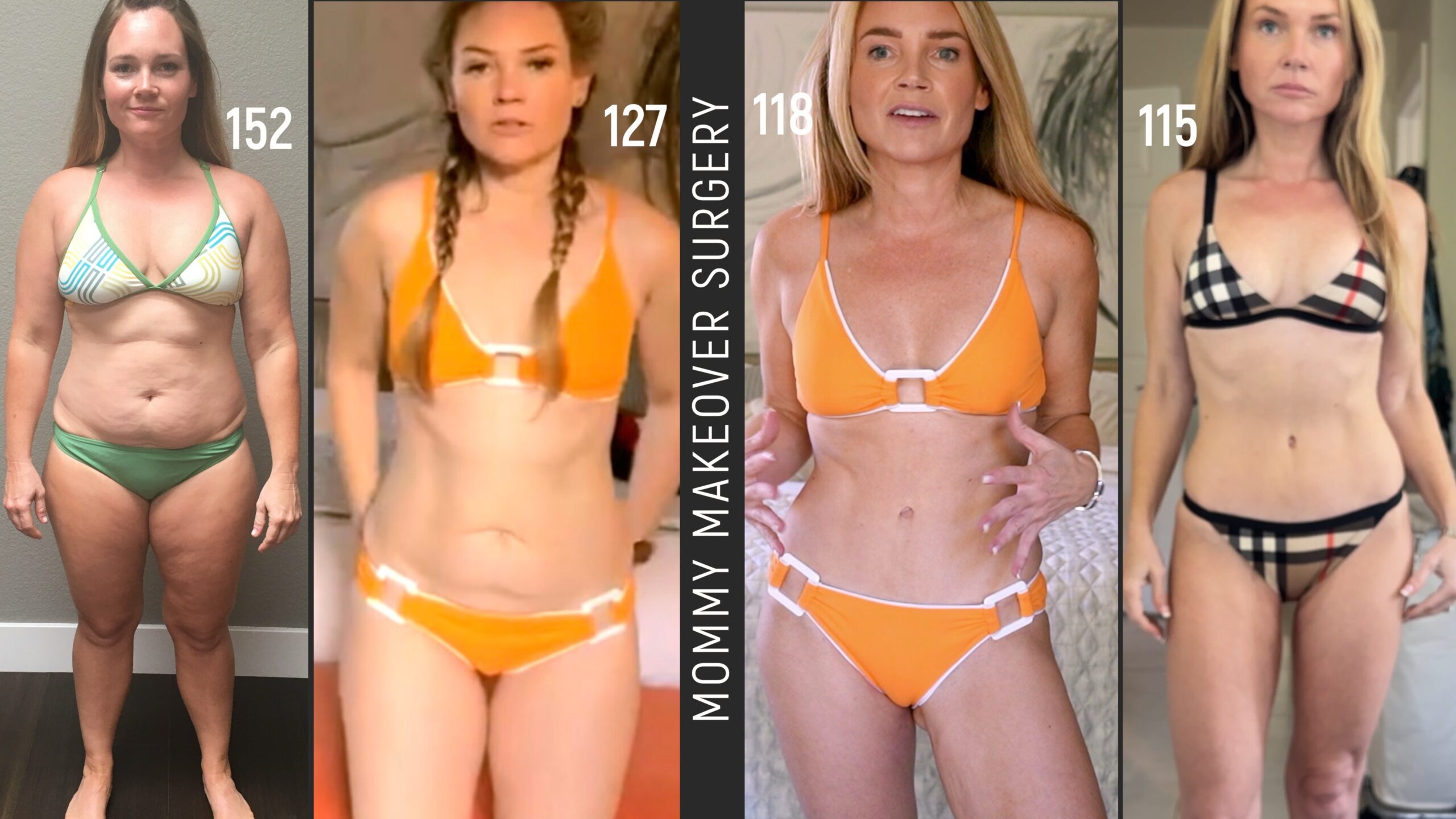 Kim Pratt documenting her earlier semaglutide weight-loss and hair-shedding story