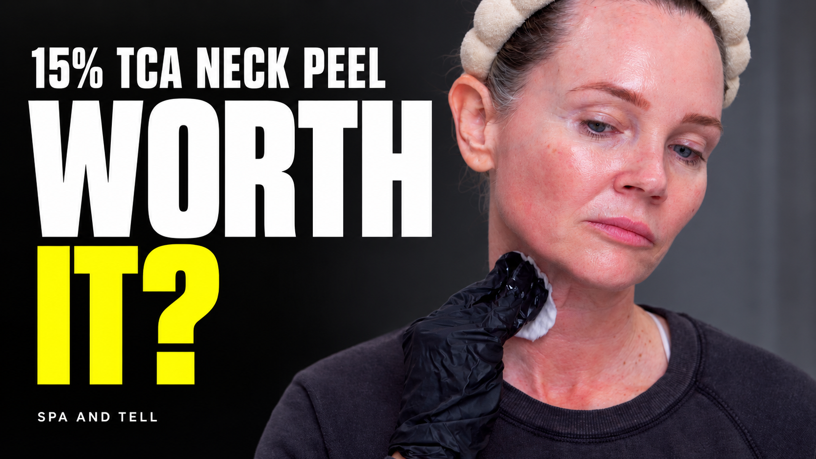 15% TCA on My Neck: Was the 12-Day Recovery Worth It?