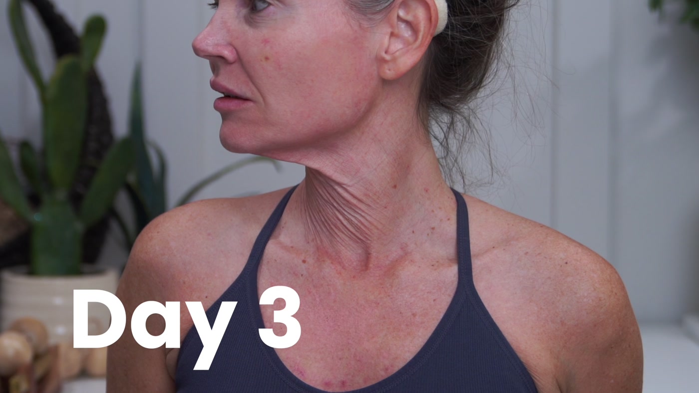 Day 3 video check-in showing Kim’s neck